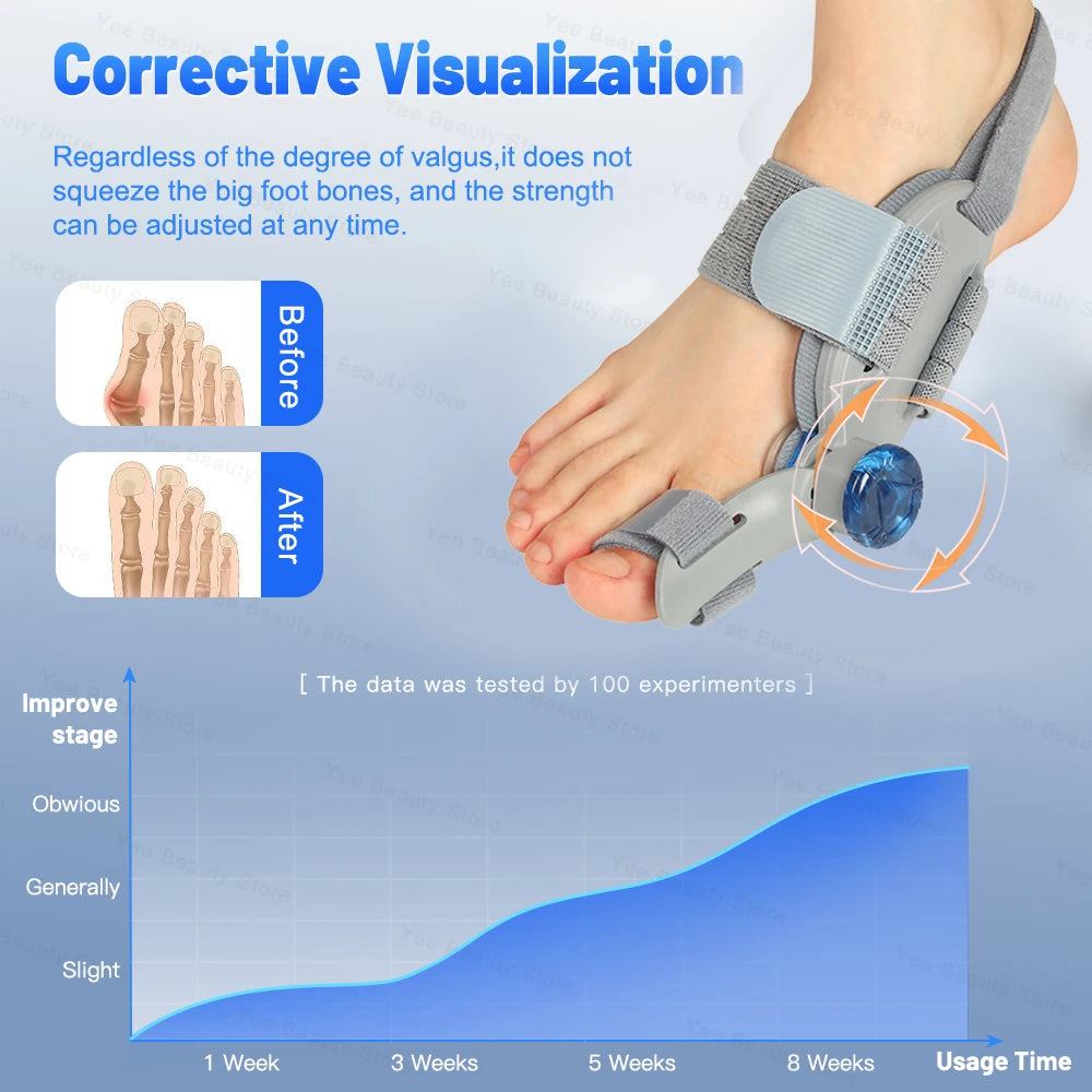 "Adjustable Bunion Corrector and Toe Separator - Hallux Valgus Relief, Toe Straightener, Orthopedic Finger and Pedicure Correction Tool"