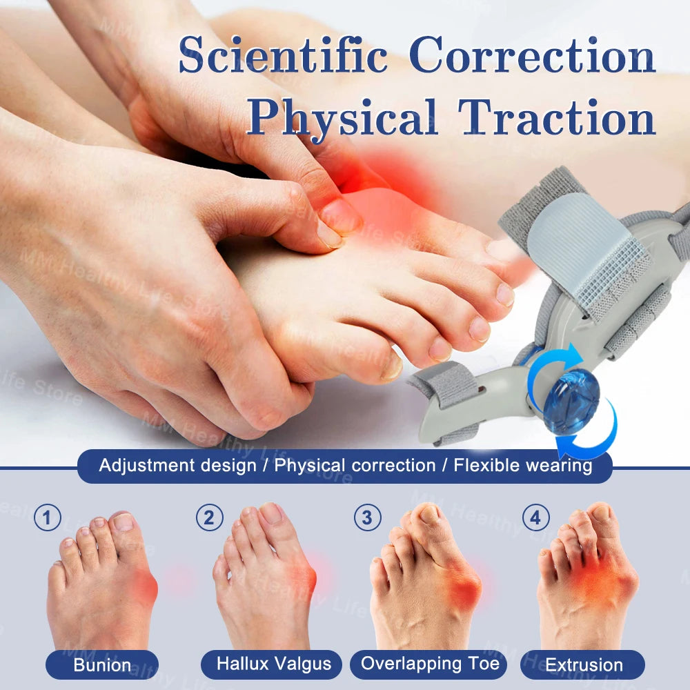 "Adjustable Bunion Corrector and Toe Separator - Hallux Valgus Relief, Toe Straightener, Orthopedic Finger and Pedicure Correction Tool"